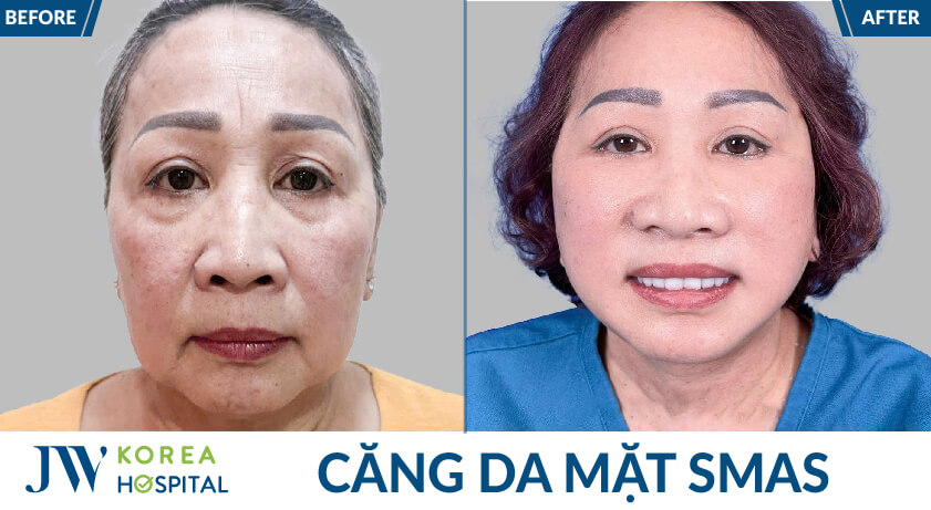 cang da mat