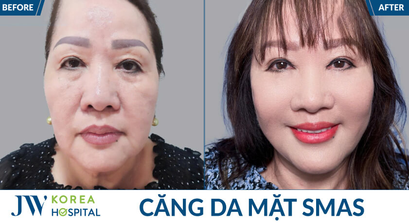 cang da mat