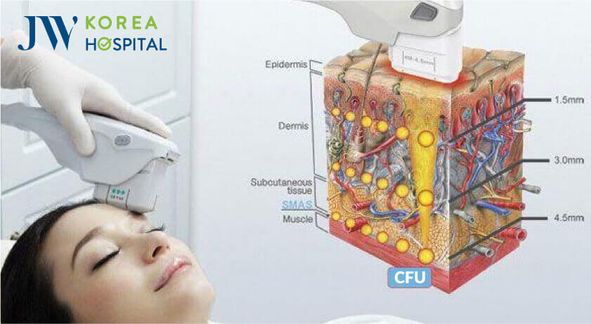 cfu 3 in 1 3d