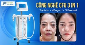 cong nghe CFU 3 in 1