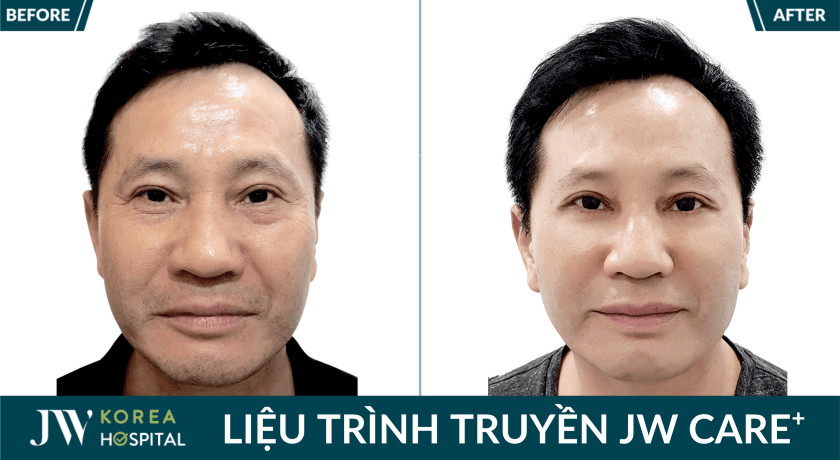 anh truoc sau khach hang 1