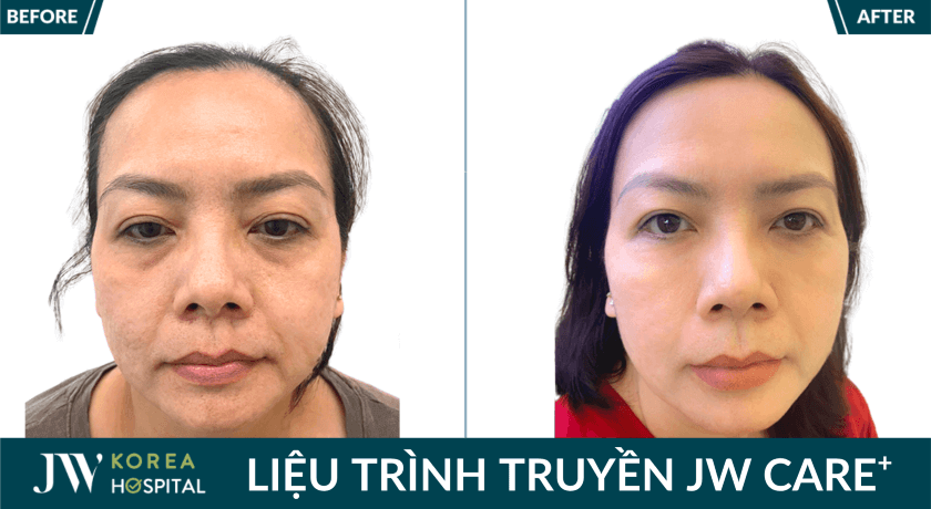 anh truoc sau khach hang 2