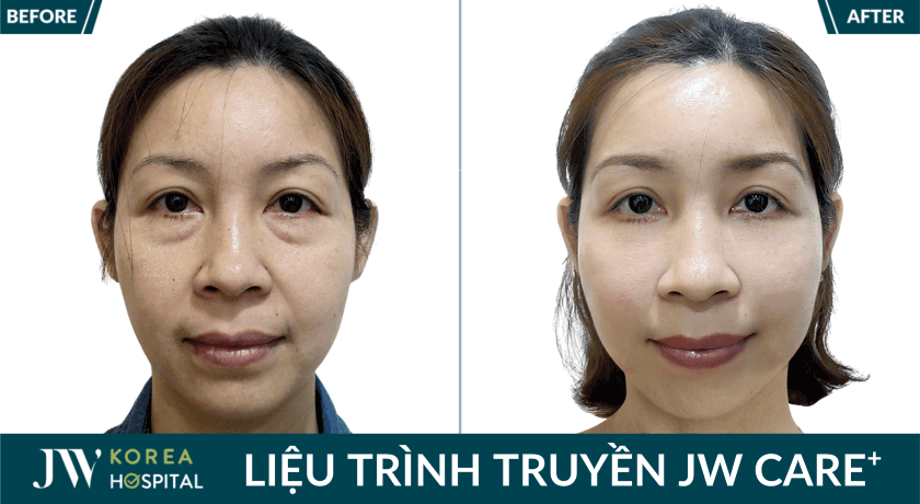 anh truoc sau khach hang 3