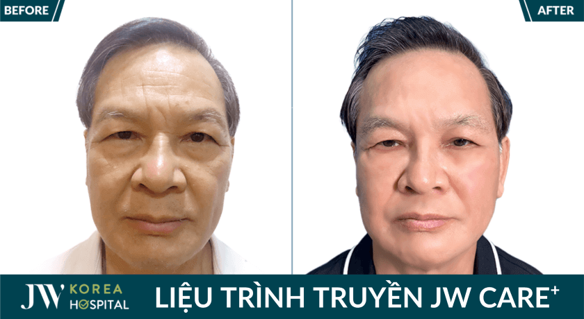 anh truoc sau khach hang 5