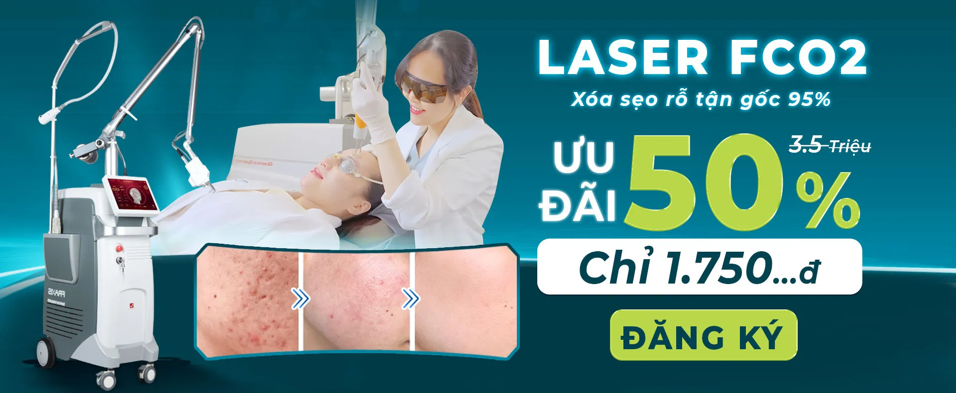 laser-seo