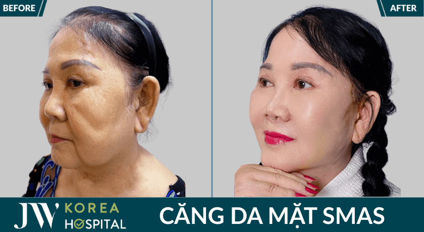 bf af cang da mat