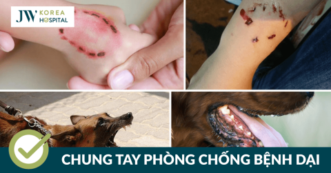 Bệnh dại nguy hiểm đến mức nào – Chuyên gia JW cảnh báo