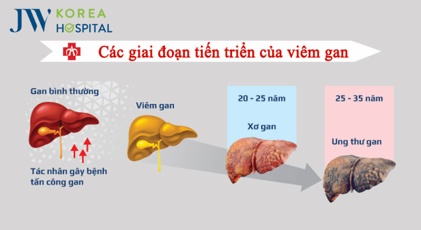 phong chong viem gan sieu vi 6