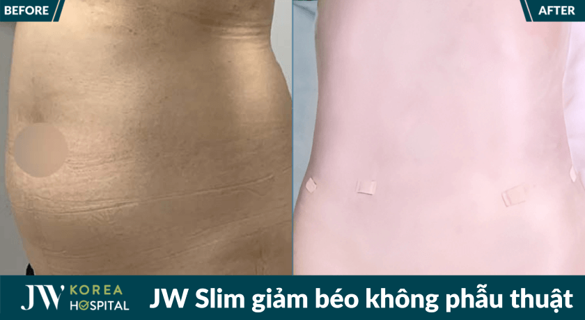 jw slim 22