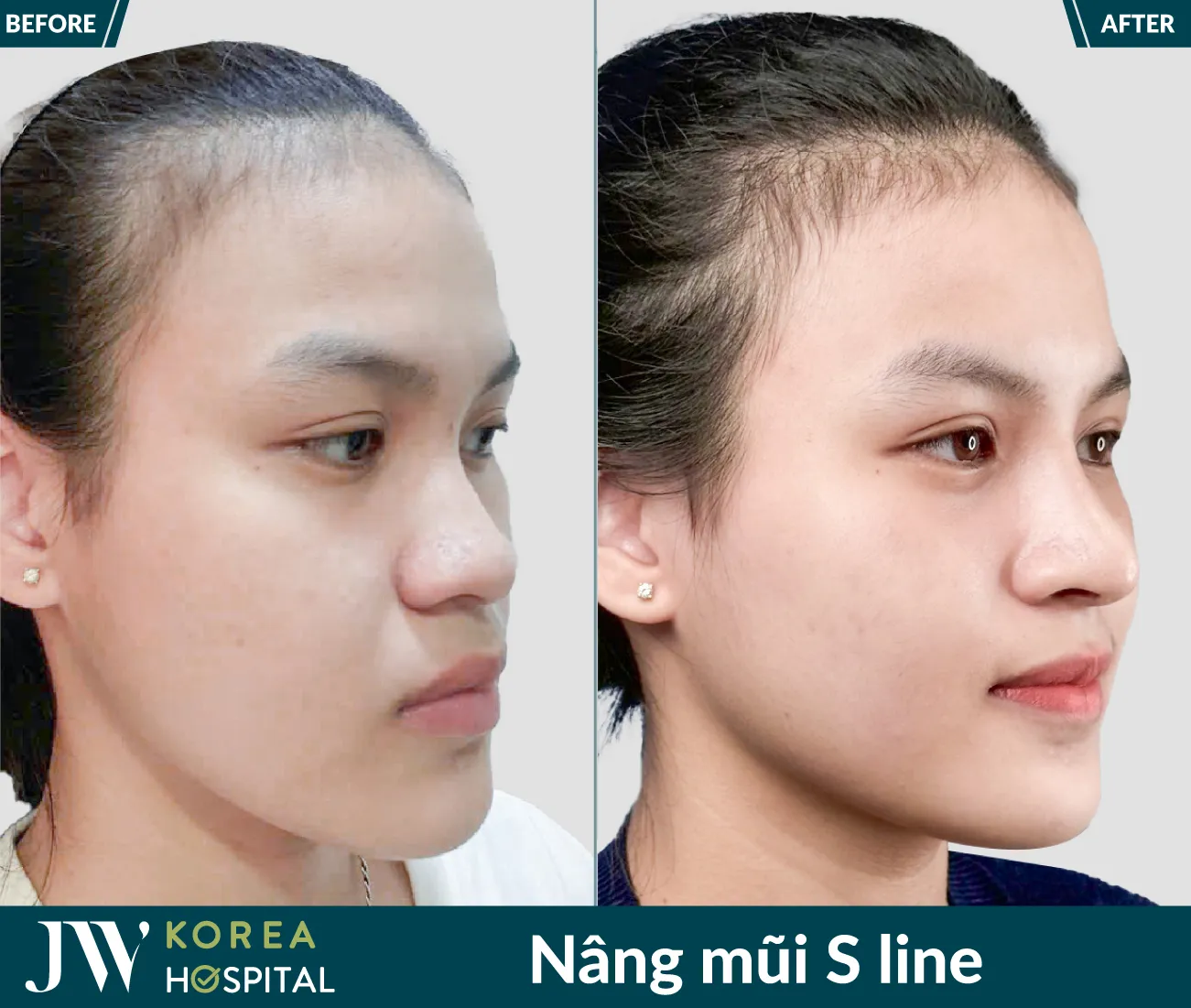 nang mui sline