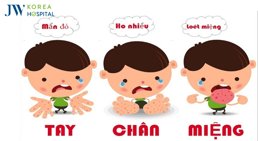 phong chong tay chan mieng