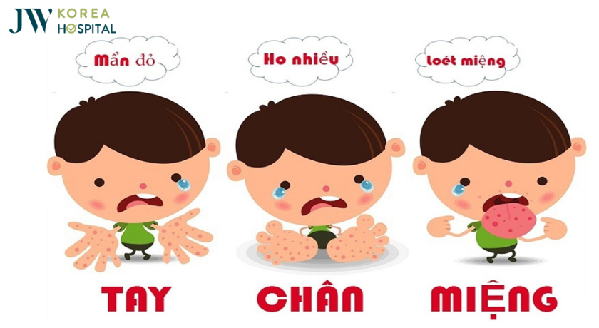 phong chong tay chan mieng