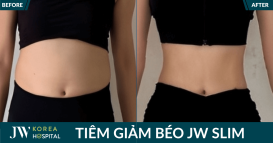 thumb jw slim (1)
