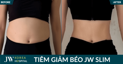 Tiêm giảm béo JW Slim: Cơ chế, cách dùng, hiệu quả thế nào?