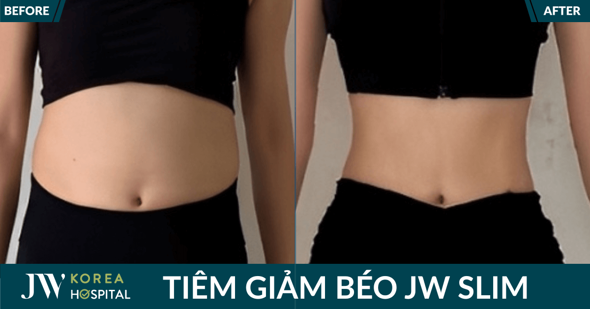 Tiêm giảm béo JW Slim: Cơ chế, cách dùng, hiệu quả thế nào?