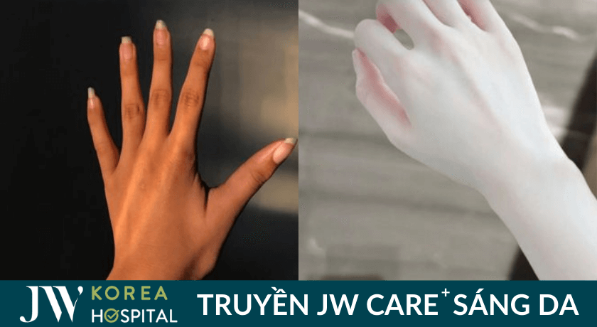 truyen sang da jw care 1 334x183