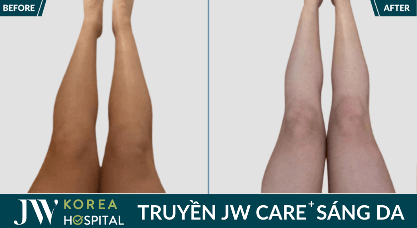 truyen sang da jw care 334x183