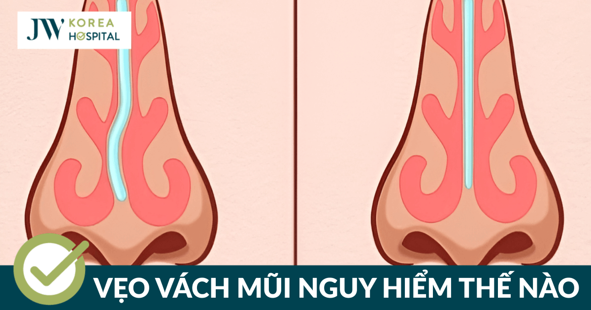 Bệnh nhân Ukraina nghẹt mũi 3 năm được chữa khỏi tại Việt Nam – Đẳng cấp y tế Việt