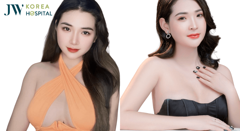 hình ảnh nâng ngực chuyển giới tại bệnh viện jw