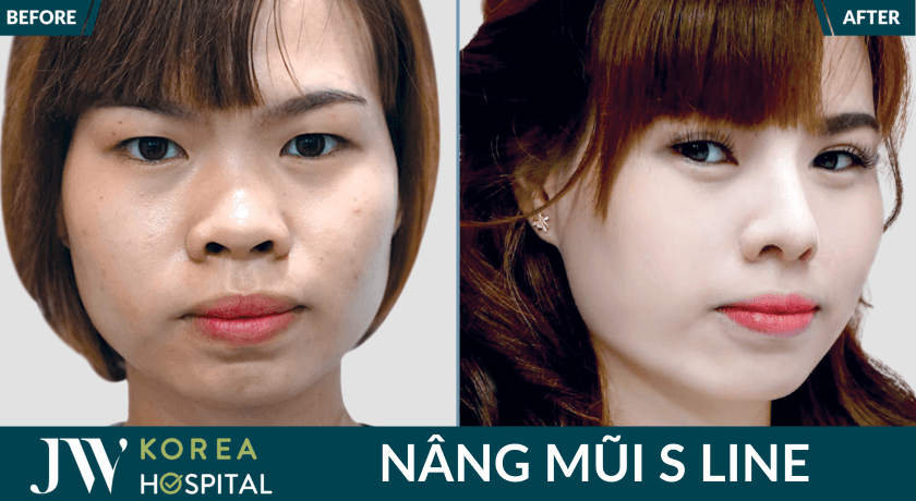 nang mui an toan tai jw