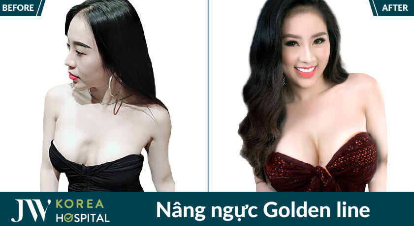 nang nguc noi soi