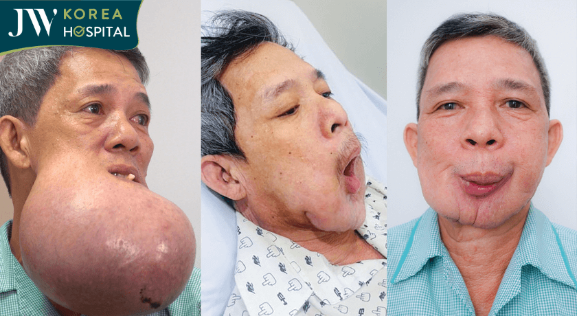 sự thay đổi chú khanh sau quá trình phẫu thuật cứu chữa