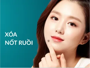Xóa Nốt Ruồi