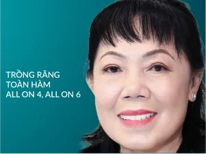 Trồng răng toàn hàm all on 4, all on 6