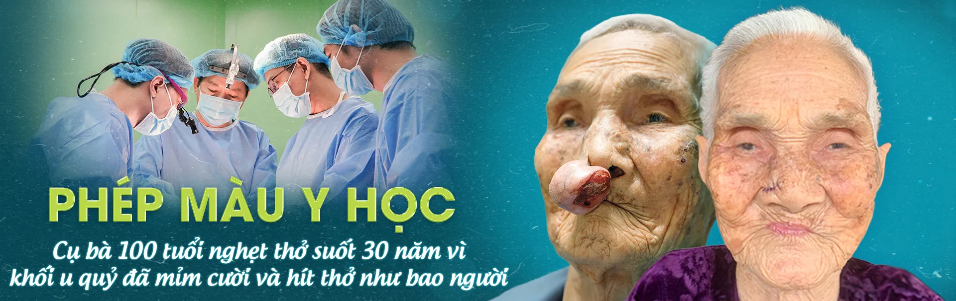 Phép màu tuổi 100: Cụ bà nghẹt thở 30 năm được bác sĩ Tú Dung cứu sống, nay đã có thể mỉm cười và hít thở bình thường