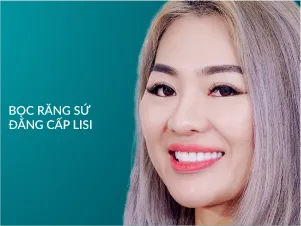Bọc răng sứ đẳng cấp Lisi