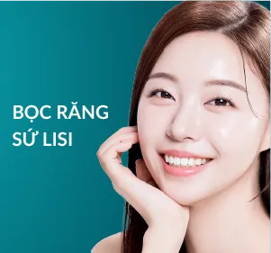 Bọc răng sứ Lisi