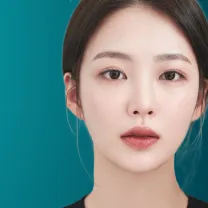 Cắt mắt hai mí