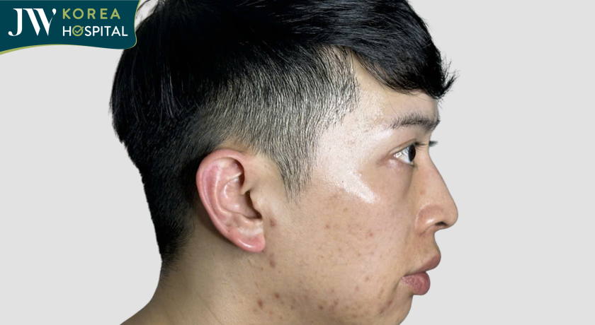 Chàng trai người Úc quyết về Việt Nam cắt mắt nâng mũi tại JW để thay đổi diện mạo