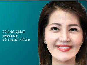 Trồng Răng implant kỹ thuật số 4.0