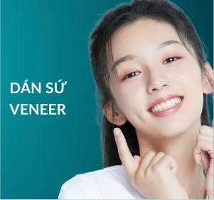 Dán sứ Veneer