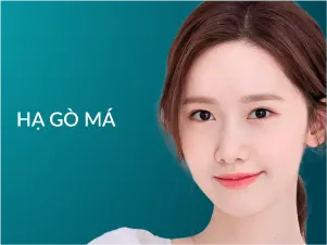 Hạ gò má
