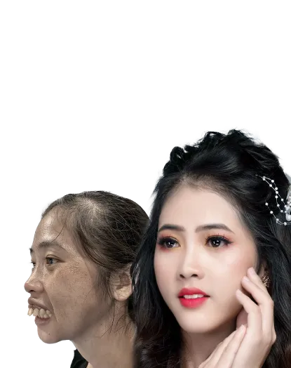 Hàm mặt