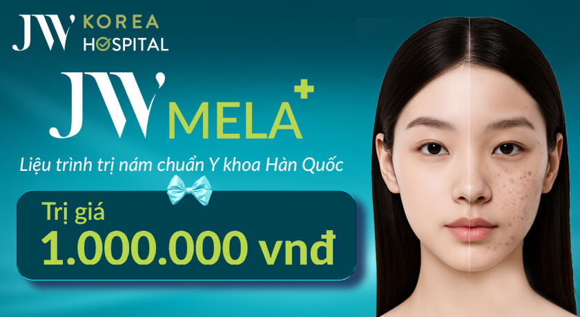 Hướng dẫn sử dụng voucher JW MELA+