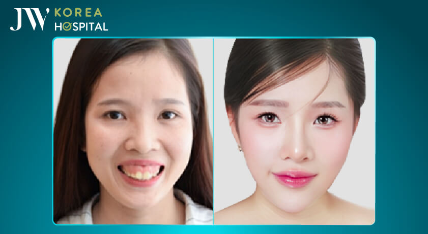 hướng dẫn sử dụng voucher làm đẹp