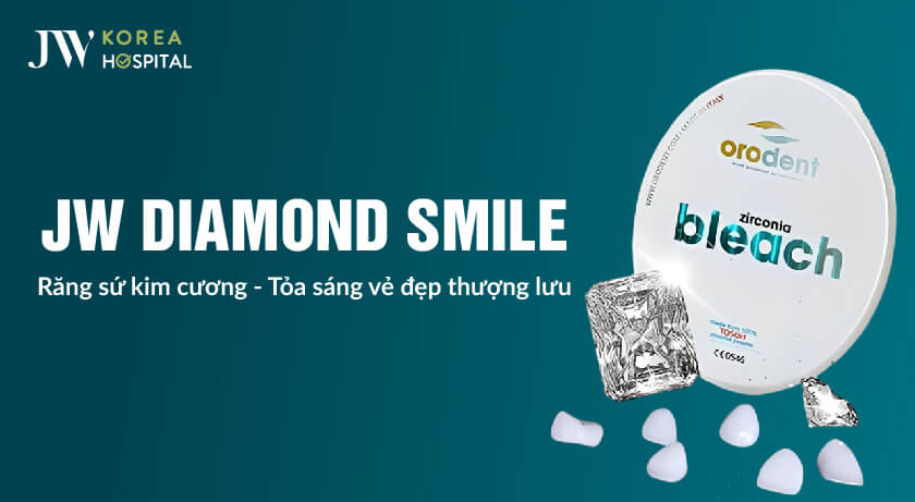 jw diamond smile răng sứ kim cương cao cấp