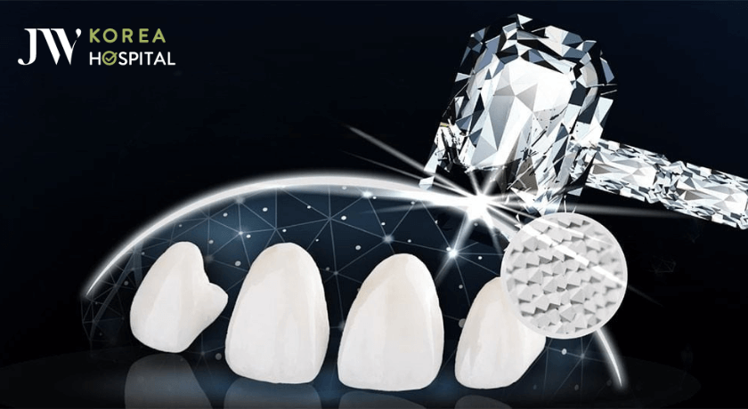 jw diamond smile răng sứ kim cương
