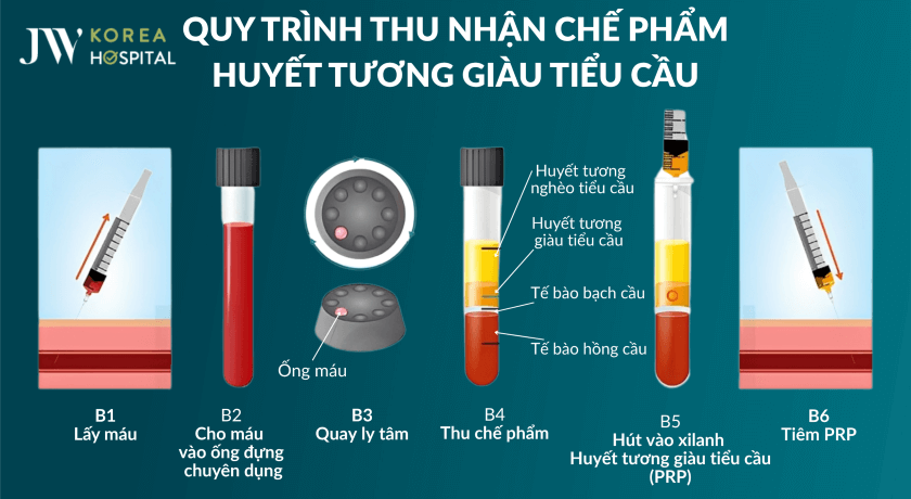 Quy trình thu nhận chế phẩm huyết tương giàu tiểu cầu PRP