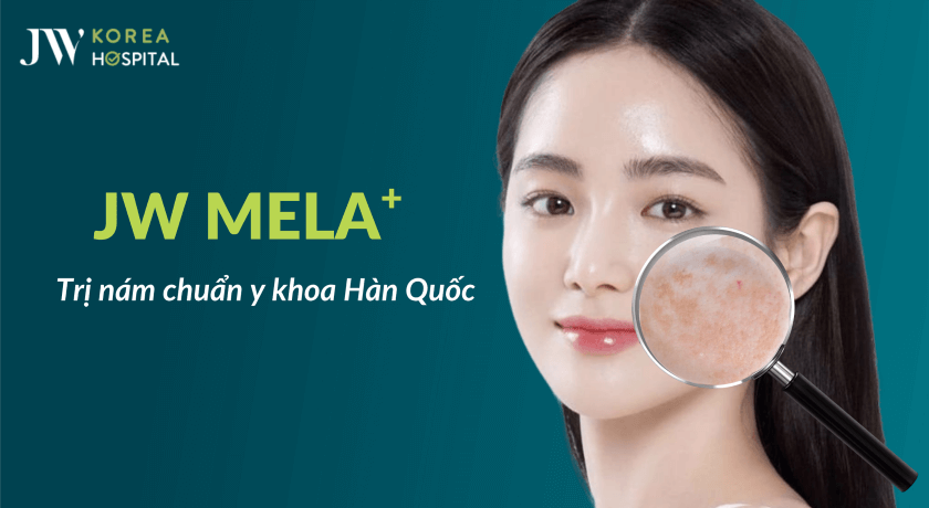 Liệu trình trị nám Mela+ chuẩn y khoa Hàn 