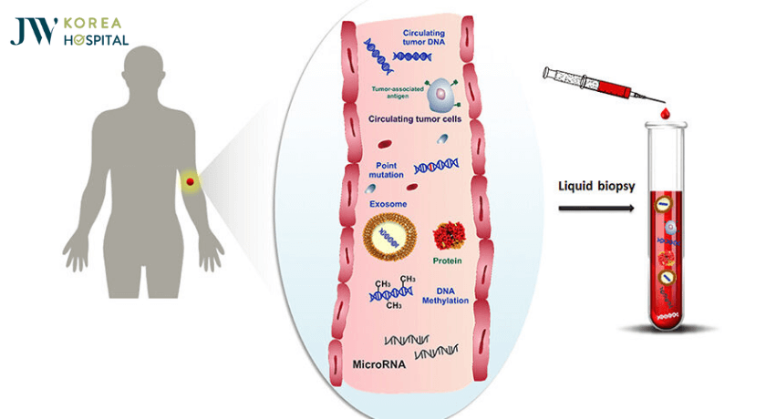 lấy máu sinh thiết ctdna