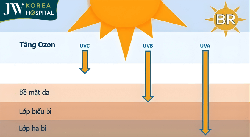 Tia UV từ ánh nắng mặt trời có thể gây nám