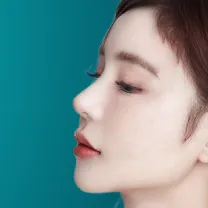 nâng mũi hàn quốc