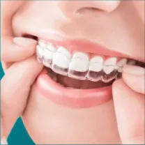 Niềng răng trong suốt Invisalign