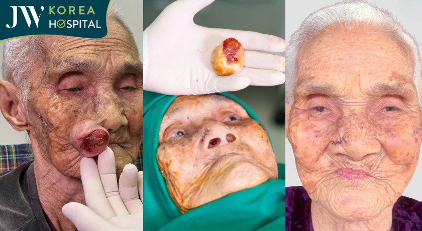 Phép màu tuổi 100: Cụ bà nghẹt thở 30 năm được bác sĩ Tú Dung cứu sống, nay đã có thể mỉm cười và hít thở bình thường