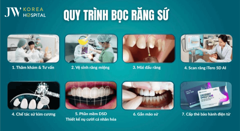 quy trình bọc ráng sứ kim cương tại nha khoa JW