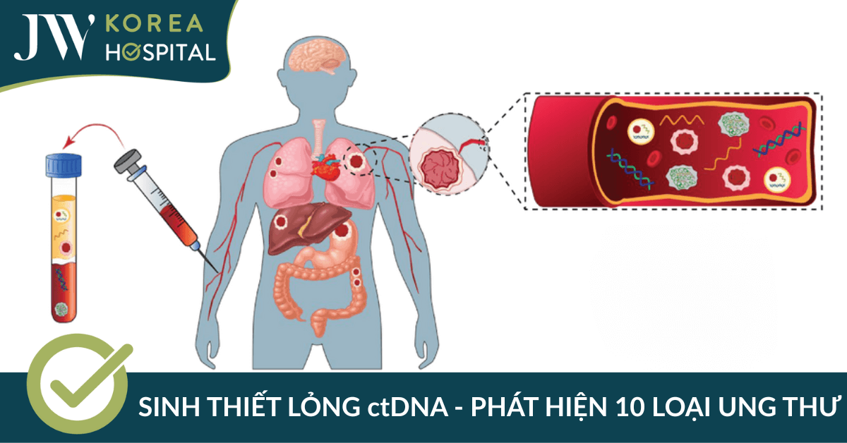 Phát hiện 10 loại ung thư chỉ trong 1 lần xét nghiệm máu – Công nghệ sinh thiết lỏng ctDNA tại JW